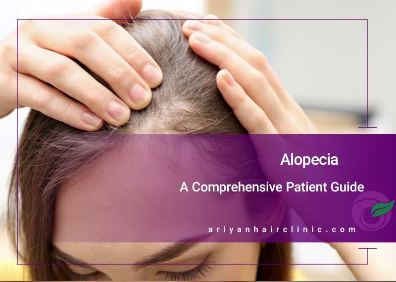 Alopecia: A Comprehensive Patient Guide